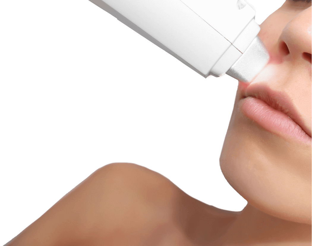 laser-hair-removal-lip