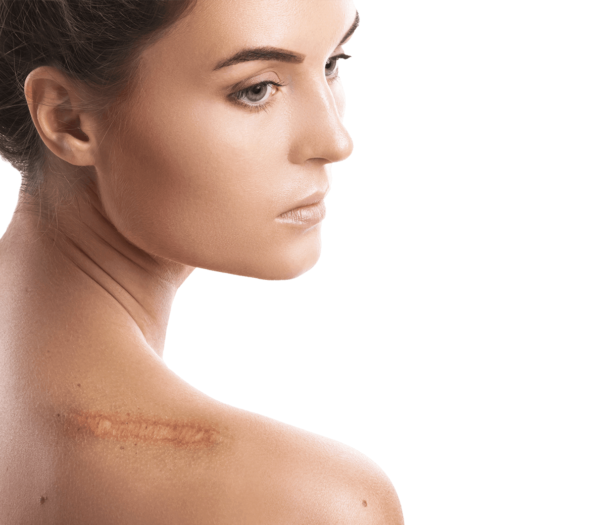young-woman-with-shoulder-scar-looking-sad-altered