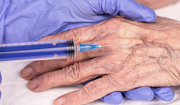 hand-sclerotherapy-vericose-veins