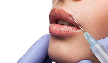 lips-restylane-injection