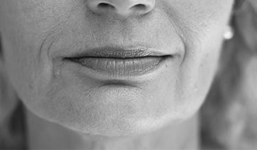 senior-woman-closeup-chin-jaw-1