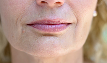 senior-woman-closeup-chin-jaw