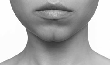 woman-with-cleft-chin-1