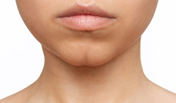 woman-with-cleft-chin