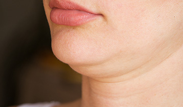 woman-with-double-chin