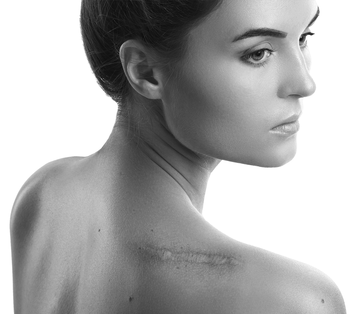 young-woman-with-shoulder-scar-looking-sad-1